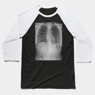 Scoliosis Xray Baseball T-Shirt